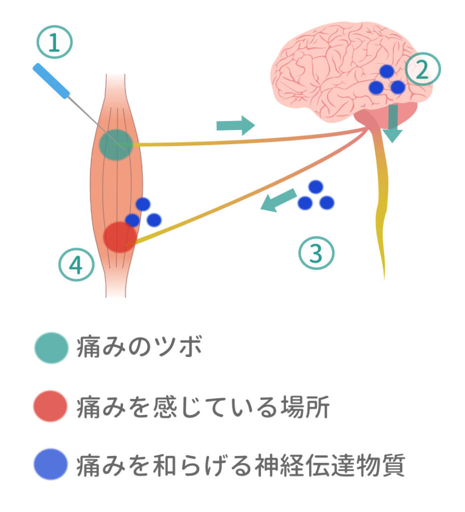 痛みのツボへの刺激で痛みが脳に伝わり痛みを和らげる物質が作用する体の仕組みを示す図